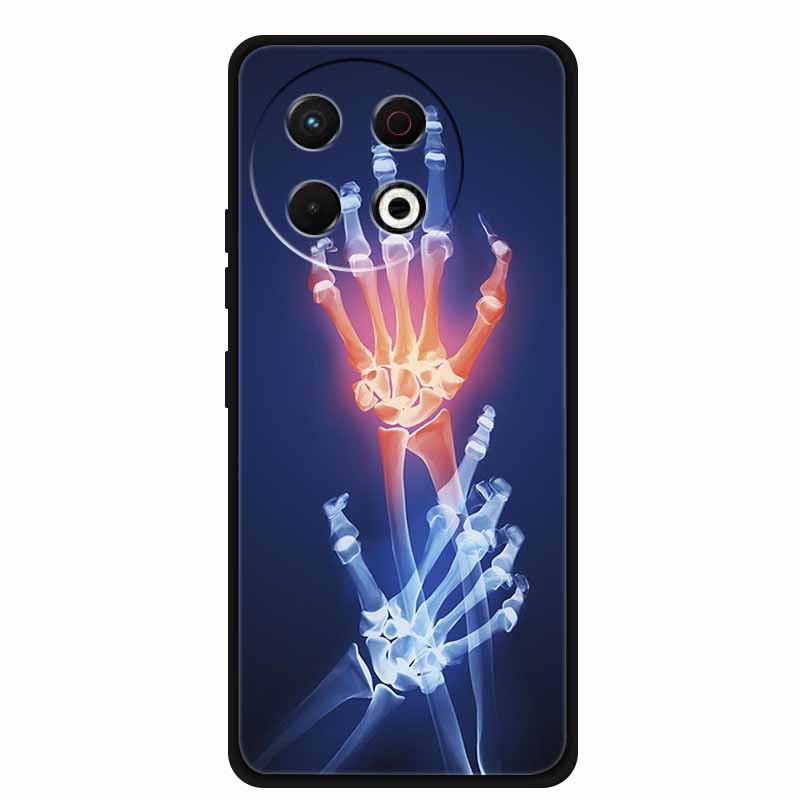 For Tecno Spark 30 Pro Phone Case 30Pro Coque Black Silicone Soft Back Cover Case For Tecno Spark30 Pro 4G Case Protective Shell