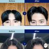 DASHU Daily Volume Pick Root Booster 1unit
