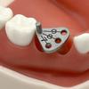Dental Implant Parallel Pin Gauge Stainless Steel Medical Locator Dental Implant Locating Guide Locating Ruler