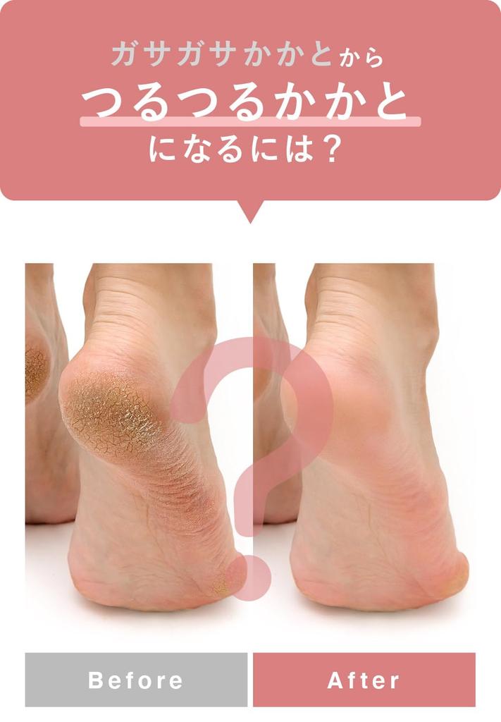 SilkTo Heel Care Moisturizing Socks and Pumice Stone Made In Silk Silk Heel Beauty Moisturizing Heel Heel Heel Dry Socks for Bare Set, Japan, Protein,