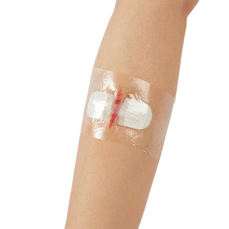 Zippered Suture-Free Tape Closure with Waterproof Patch