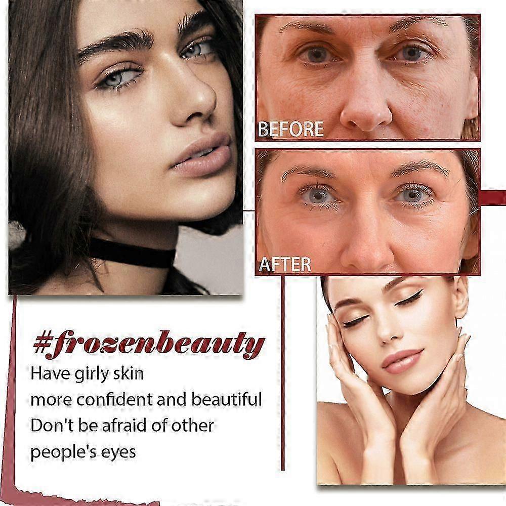 Retinol B3 Serum, Retinol Face Serum With Vitamin B3, B3 Retinol Serum For Face Anti Aging, Retinol Anti-wrinkle Serum Repair Wrinkles