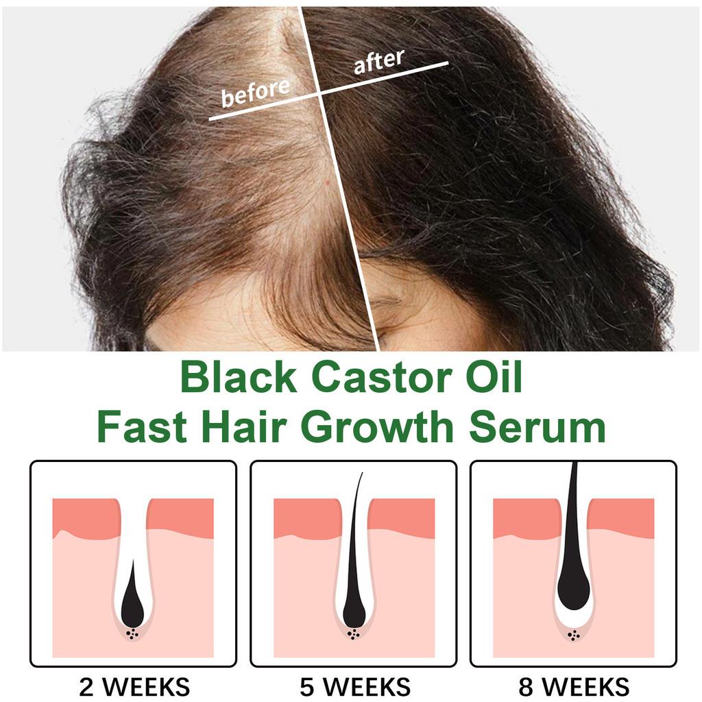 Jaysuing Castor Oil Hair Growth Essence Nourishing Thickening Strengthening Formula