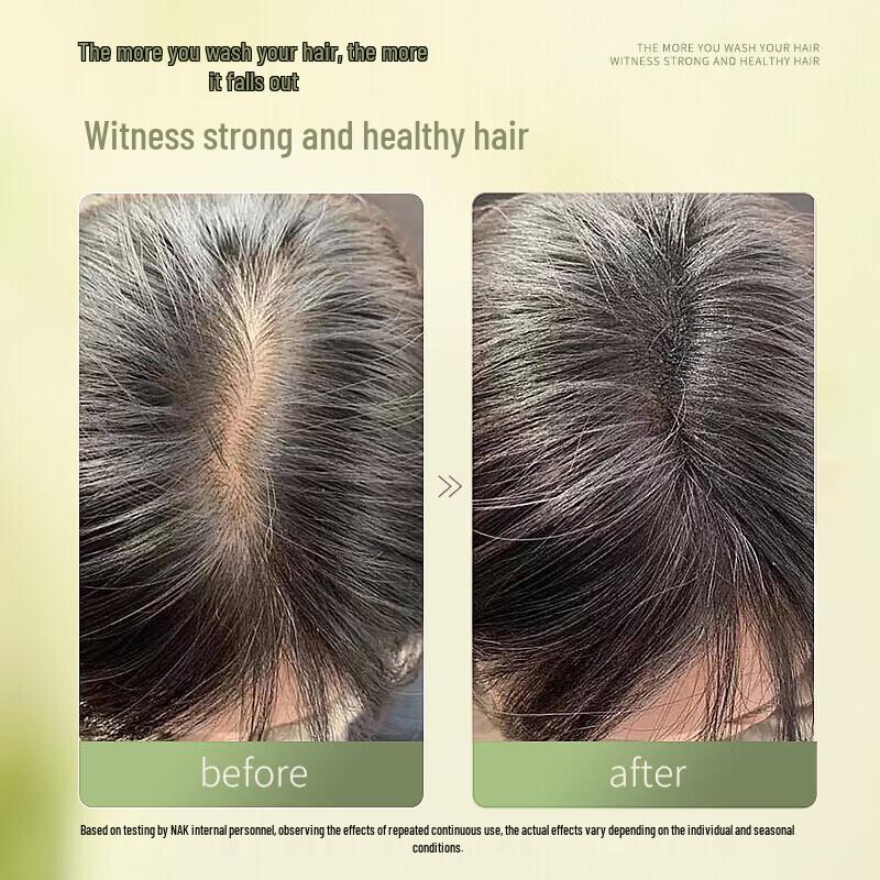 Nak Tea Tree & Ginger Anti-Hair Loss Shampoo