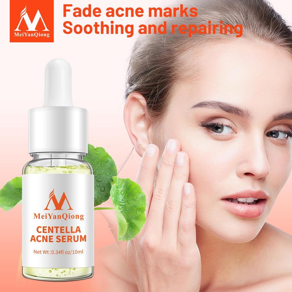 Centella Asiatica – sérum pour le visage, Essence anti-acné, liquide, hydratant, Anti-rides, rétrécissement des pores, huile de contrôle, blanchit la peau