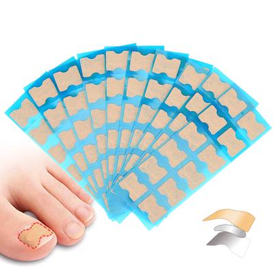 Strumento per il trattamento dell'unghia del piede con adesivo per pedicure per la cura del piede, patch per la correzione dell'unghia del piede incarnita