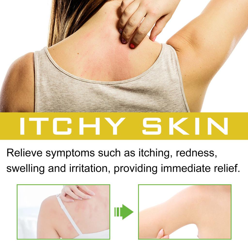 South Moon Skin Repair Spray Relieves Discomfort Nourishes Smooths Skin Care