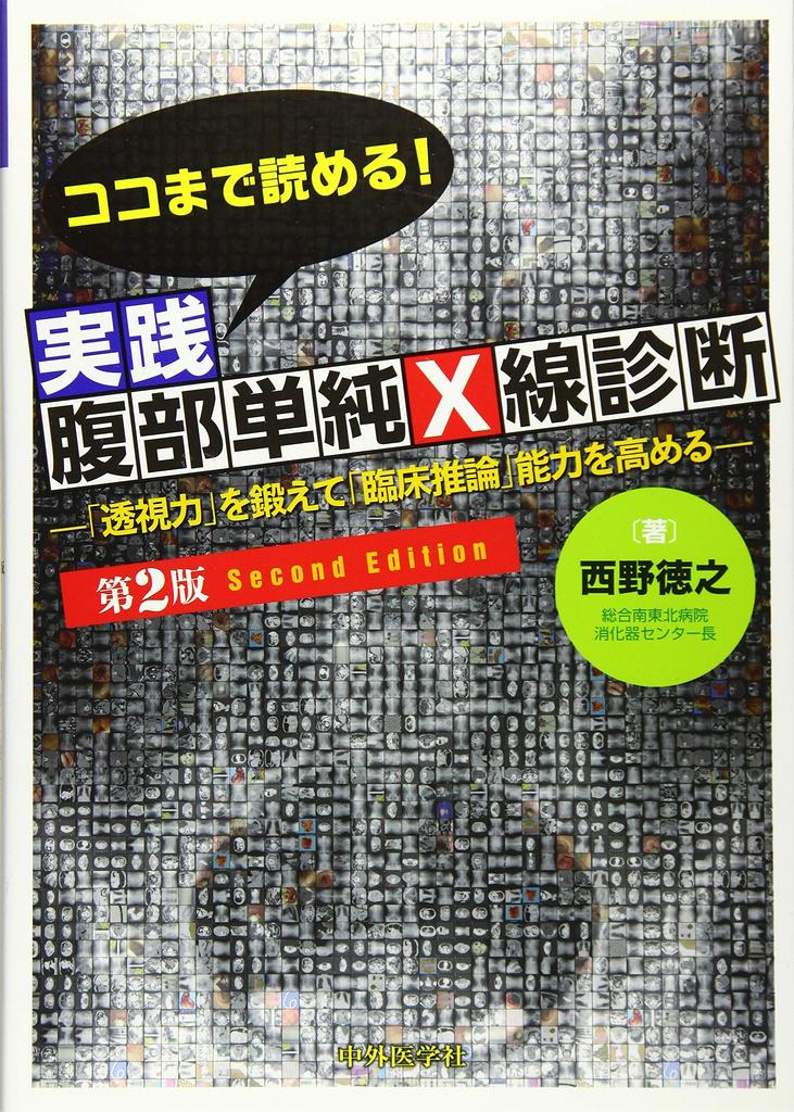 Read up to here! Practical Abdominal X-ray Diagnosis, 2nd Edition