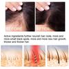 OUHOE Ginger Hair Essence 30ml promotes hair growth, prevents dry, damaged, and thinning hair, and acts as an anti-hair loss and hair growth spray