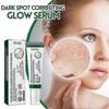 1/2/3Pcs Dark Spot Correcting Glow Serum, Anti-Aging & Anti-Hyperpigmentation Serum for Brighter Skin - 1191823