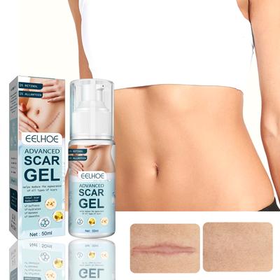 Acne Scar Removal Cream Gel Skin Care Stretch Marks Remove Acne Spots Surgical Scars Treatment Smooth Whitening Beauty Cosmetics