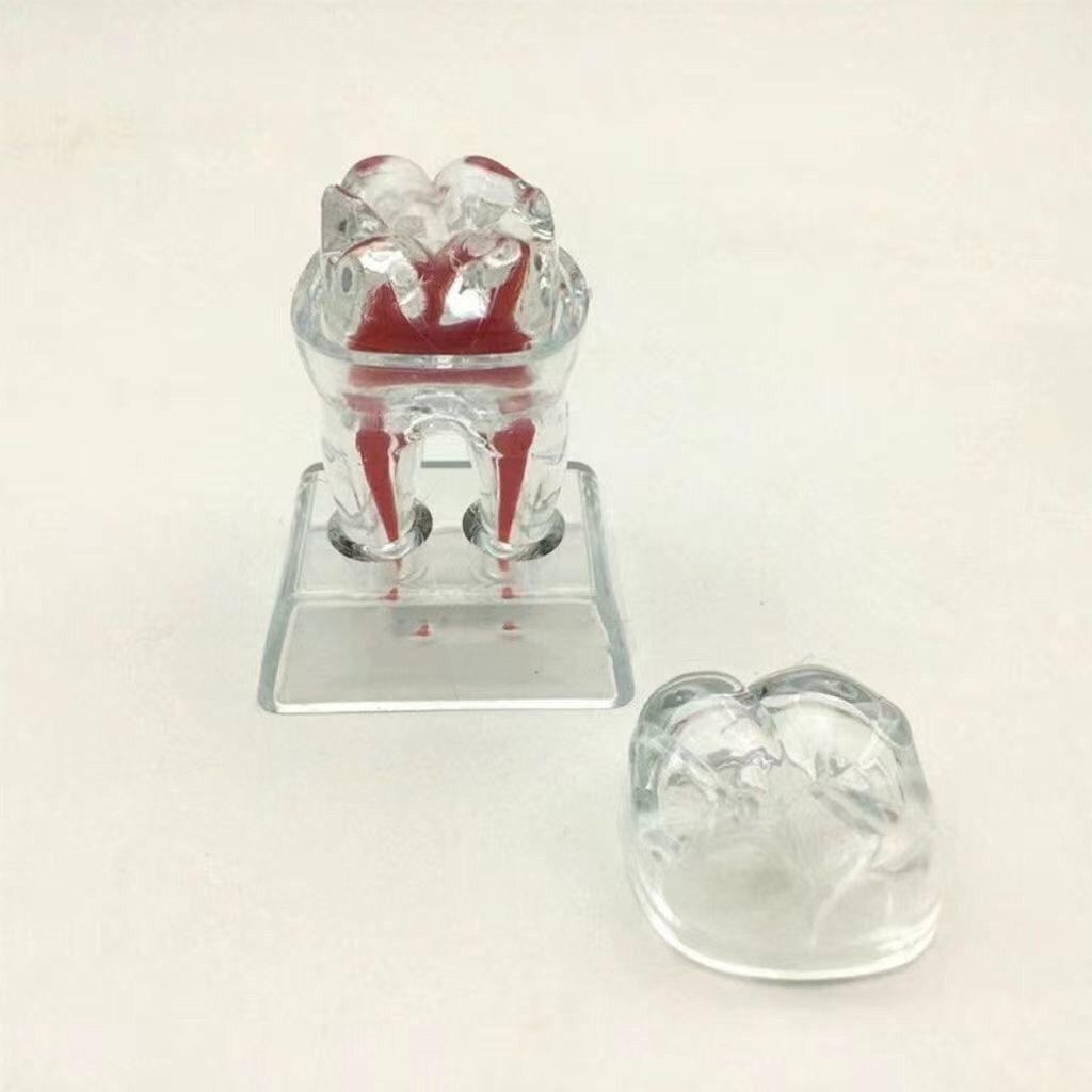 5 Pcs Dental Anatomical Model Transparent Luminous Detachable Single Tooth Decomposition Dentistry Clinic Ornaments