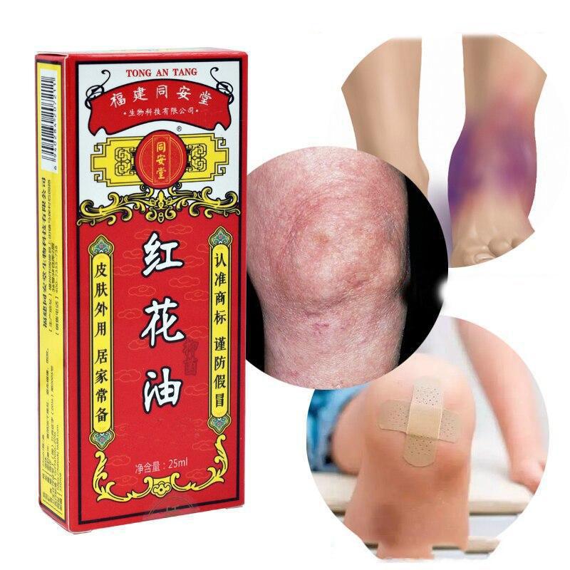 1 chinesisches Öl Tiger Balm von Schmerzlinderung von Box Muskelschmerzen, Prellungen, Schwellungen Umschlag