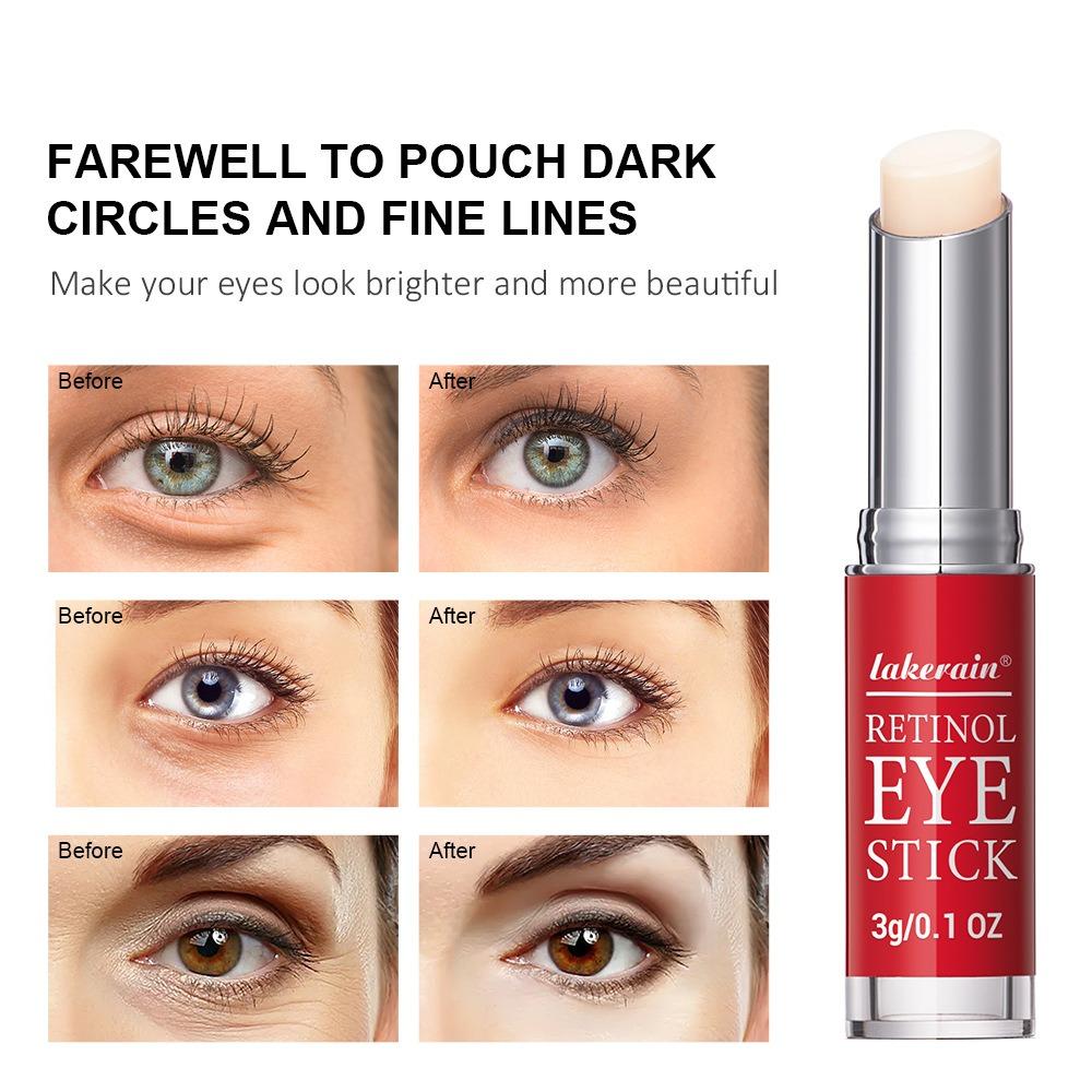 Lakerain Retosol Eye Cream Stick To The Eye Bag for å forbedre mørke sirkler øyekrem