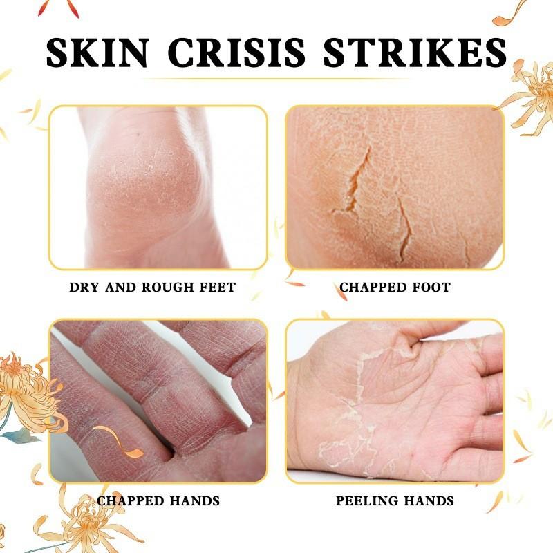 Jaysuing Three Flower Three Seed Hand And Foot Essence Oil For Deep Moisturizing Skin