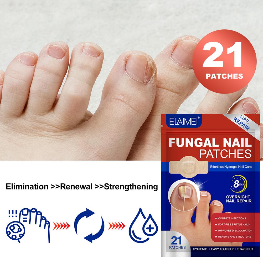 Szary plaster na paznokieć u stopy Plaster do naprawy paznokci grzybiczych Plaster korygujący wrastające paznokcie Pielęgnacja paznokci u stóp Plaster do leczenia zanokcicy 1/5 opakowań