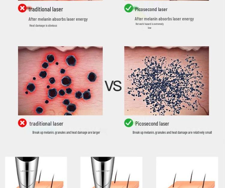 Portable Picosecond Laser Pen for Tattoo, Freckle, and Eyebrow Removal with Red & Blue Light