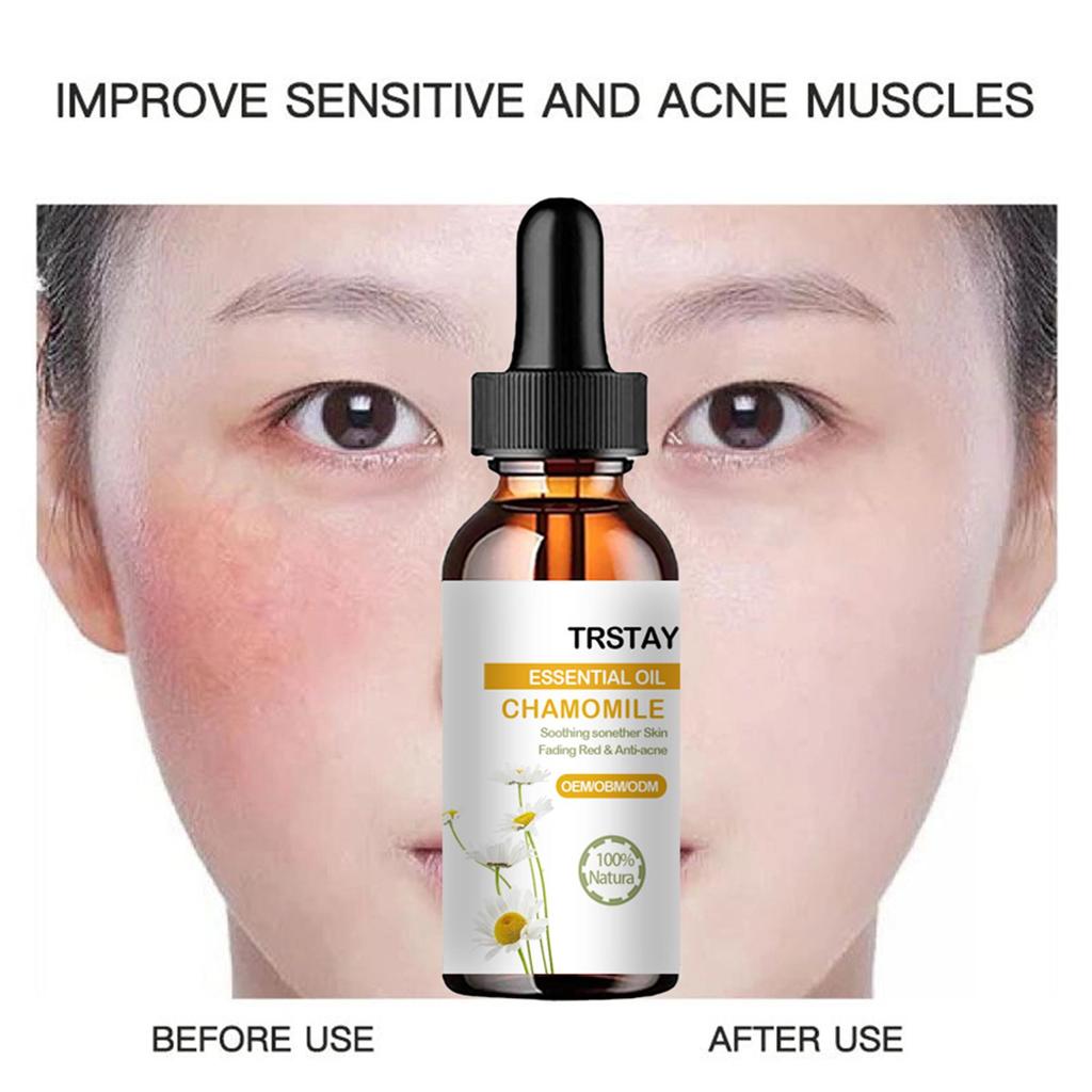 Dark Spot For Face, Dark Spot Corrector Cream, Ingredient, Enriching Skin Care For All Skin Tones, Melasma, Freckle, Sun Spot Improving