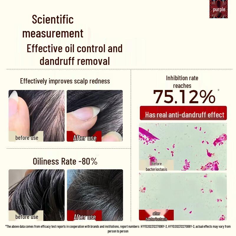 Long Hair Xiaozhai Rice Water 3 Probiotic Anti-Dandruff Shampoo