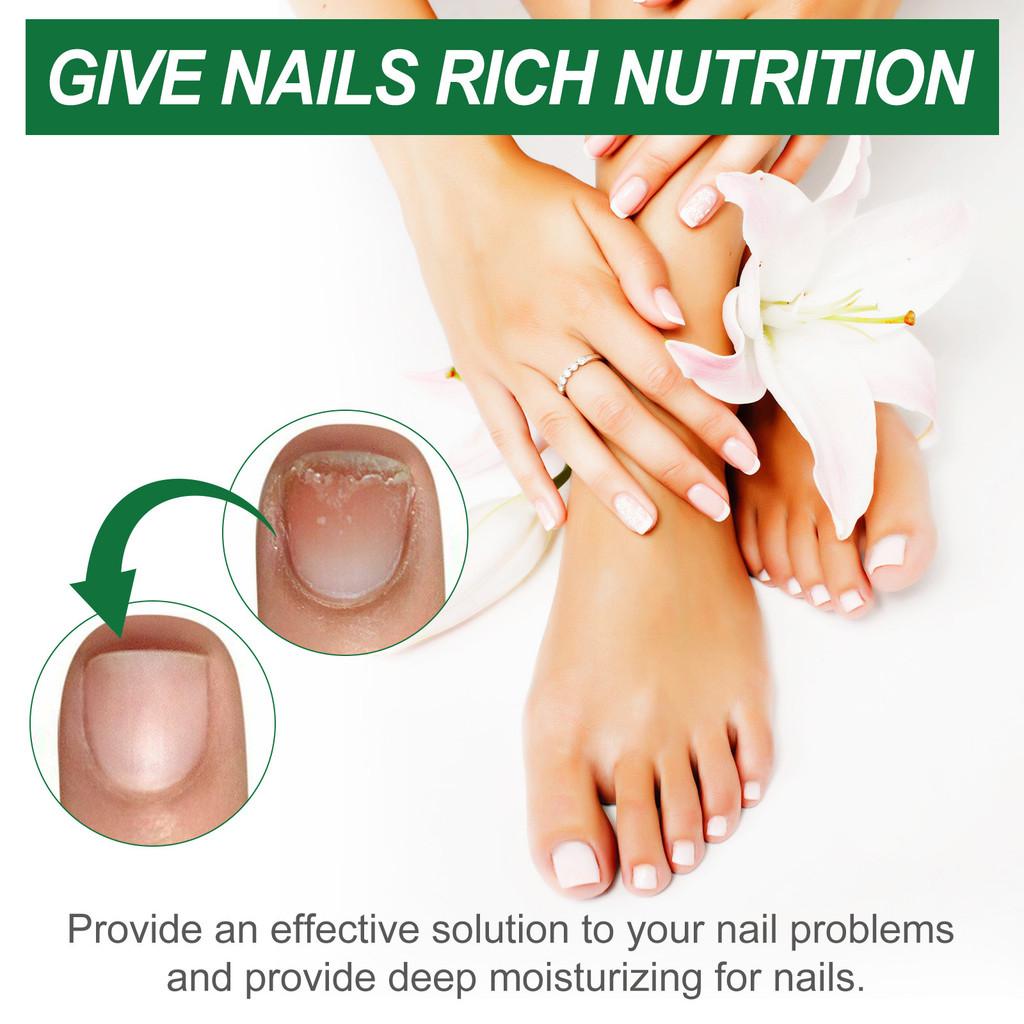 Ximonth Nourishing Toenail Care Liquid For Healthy Strong Nails And Beautiful Shine