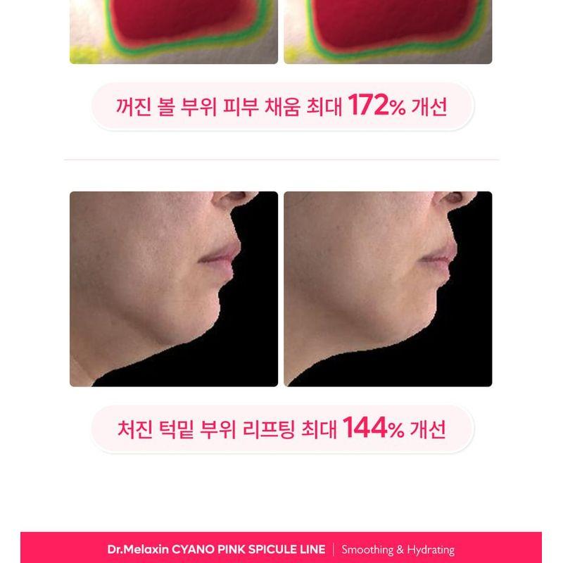 Dr.Melaxin - Cemenrete Cyano Pink Spicule Cream