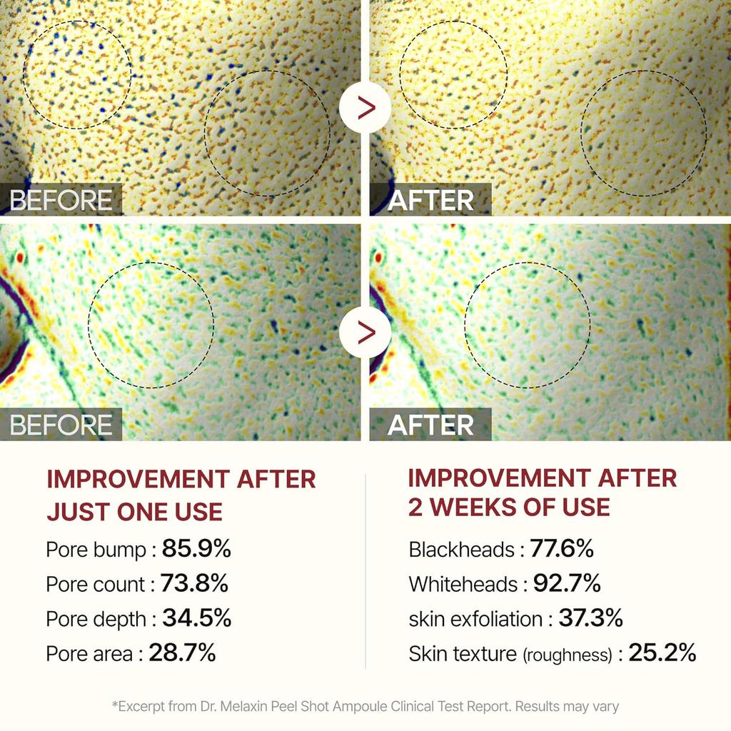 Dr.Melaxin Peel Shot Exfolierende Schwarzreis-Ampulle 80ml