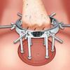 Metal Anal Expander Vaginal Dilator Spreader Huge Speculum Fetish Masturbation Anal Plug Fisting BDSM SM Sex Toys for Men Women Couples