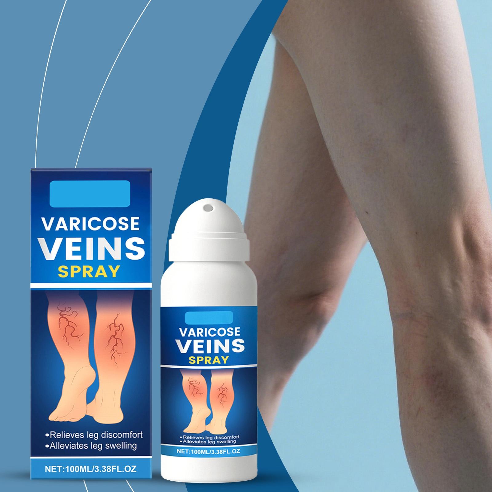 

Спрей от варикозного расширения вен Травяной спрей от варикозного расширения вен Успокаивающий спрей для ног Уменьшает отечность Спрей для ухода за ногами, 100 мл One Size белый