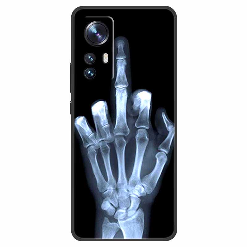 For Xiaomi 12 Lite 5G Case Shockproof Soft Silicone TPU Back Cover For Xiaomi Mi 12 Lite 5G Phone Case Mi12Lite 12Lite Cartoon