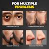 Beardo Ultra Glow Brightening Face Serum For Men 30 ml With Niacinamide Vitamin C For Even Skin Tone Radiant Look