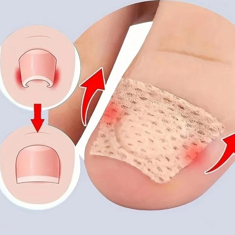 Zehennagel Korrektur Patch Nagel Erholung Zehenpflege Werkzeug Nagelwerkzeug Korrektur Pediküre Werkzeugset