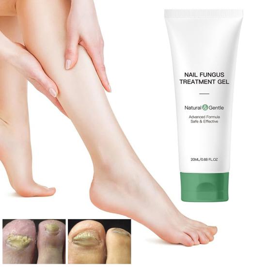 1/2Pcs 20ML Nail Fungus Treatment Gel Natural Ingredients Portable Men Women Hydrating Moisturizing Multi-Purpose