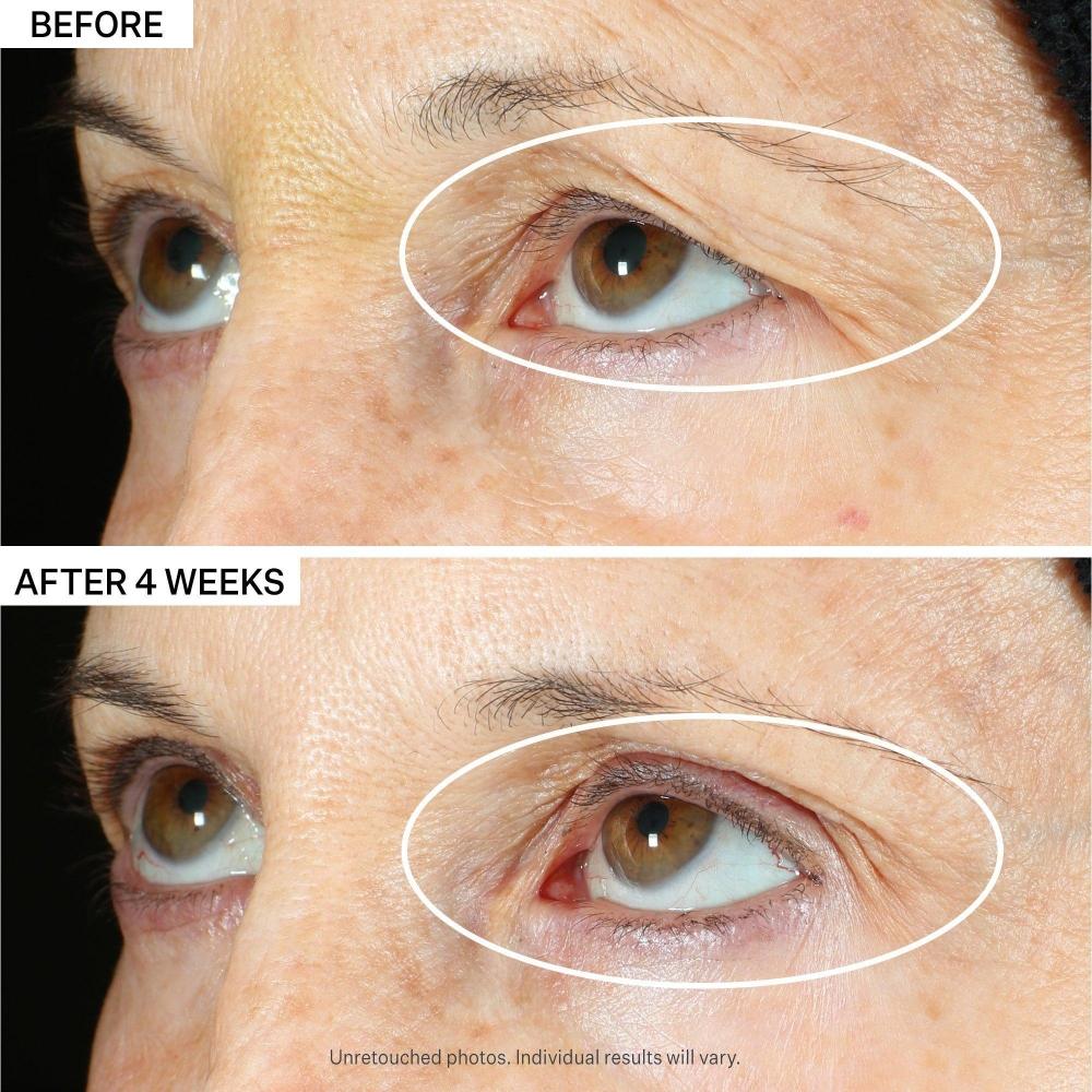 Strivectin Peptight 360 Sérum Yeux Raffermissant 1.0 oz