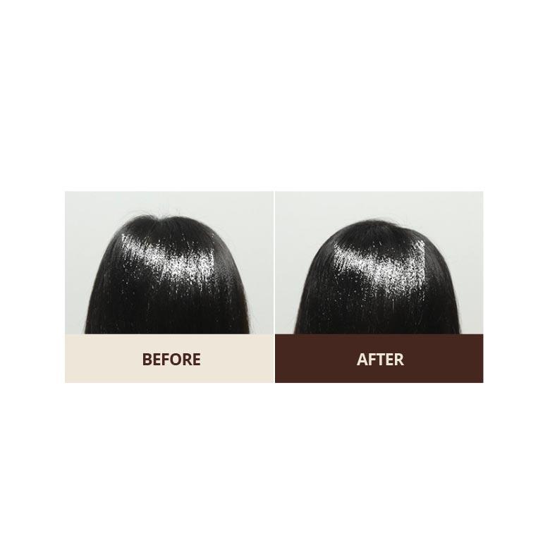 NEEDLY The Secret Anti Hair Loss Treatment 250ml