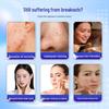 Gezichtsverzorging – Acne producten