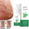 Herbal Anti Crack Foot Cream Spray Heel Cracking Repair Products Exfoliation Dead Skin Removal Softening Moisturize Smooth Care