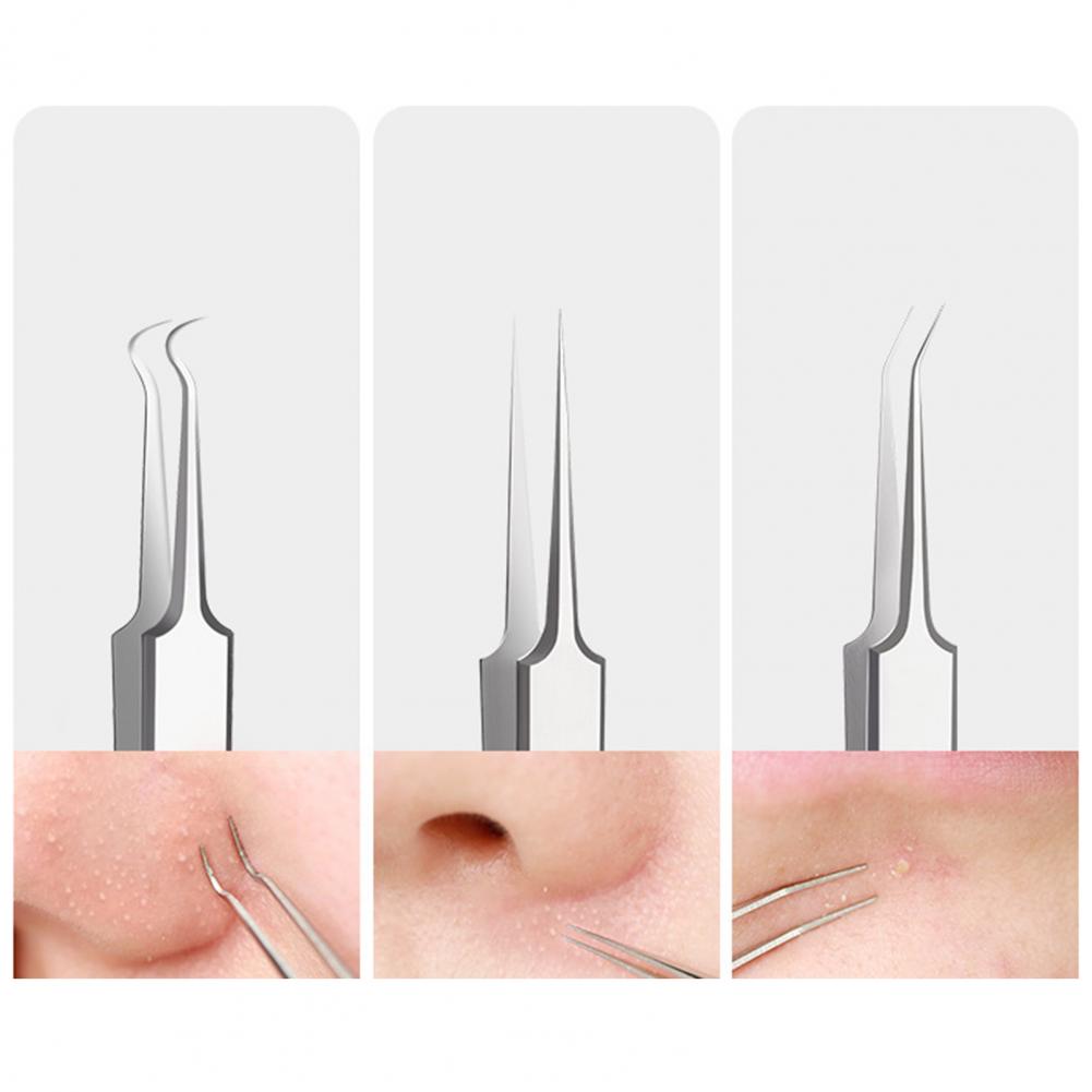 Blackhead Remover Kit Stainless Steel Acne Needle Tweezers Set for Facial Cleansing Tools Professional Pimple Popping Tools