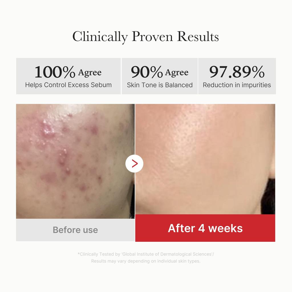 MediCube Red Peeling Toner Pads     Exfoliating, Pore-Cleansing, Brightening Skincare Pads