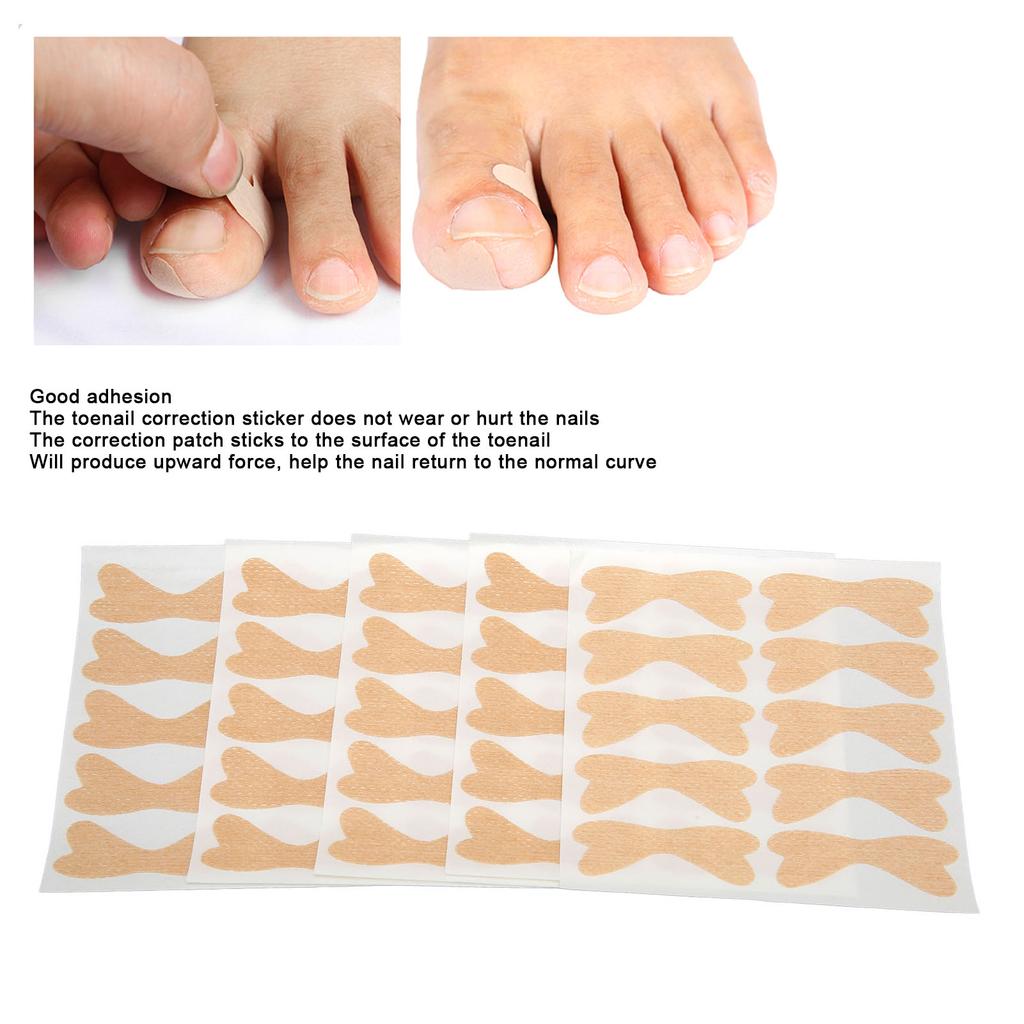 50pcs Ingrown Toenail Correction Patch Good Adhesion Elastic Breathable Toenail Correction Sticker Set