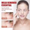 Speedy Milia Remover Treatment Cream, Helps Dissolve and Reduce Milia, Whiteheads, Blackheads, 30ml