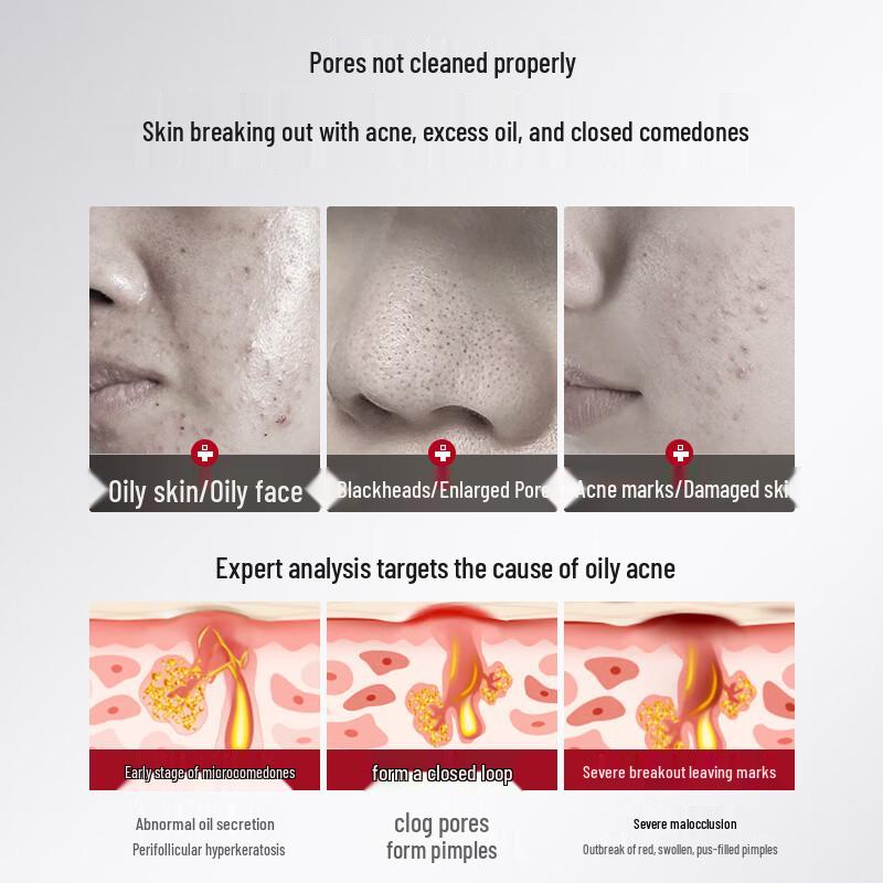 HURMEVKOR Salicylic Acid Acne Treatment Pads