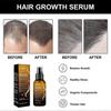 Biotin Hair Growth Serum Spray, Biotin Hair Regrowth Topical Solution Anti Hair Loss Treatment Hair 