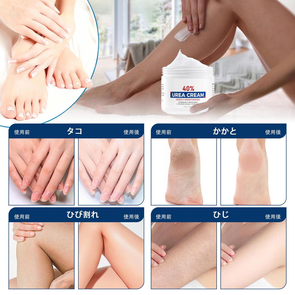 Yashenshi Urea Cream 150g Hand and Foot Moisturizing cream containing urea for cracked and Made from corn 40%, Cream. dry, feet, heels, knees, elbows,