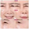 TOSOWOONG SOS Intensive Magic Clinic Anti-Wrinkle Patch