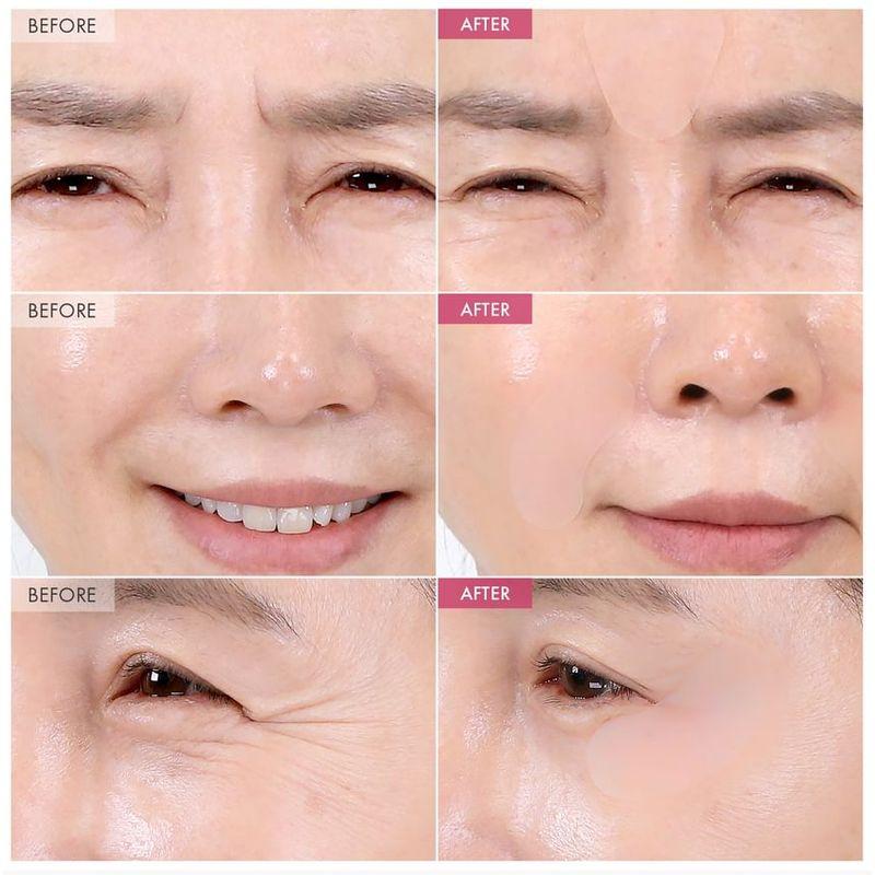 TOSOWOONG SOS Intensive Magic Clinic Anti-Wrinkle Patch