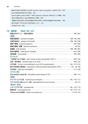 Easy-to-understand Brain MRI, Revised 4th Edition (Image Diagnosis Special Edition KEY BOOK Series)