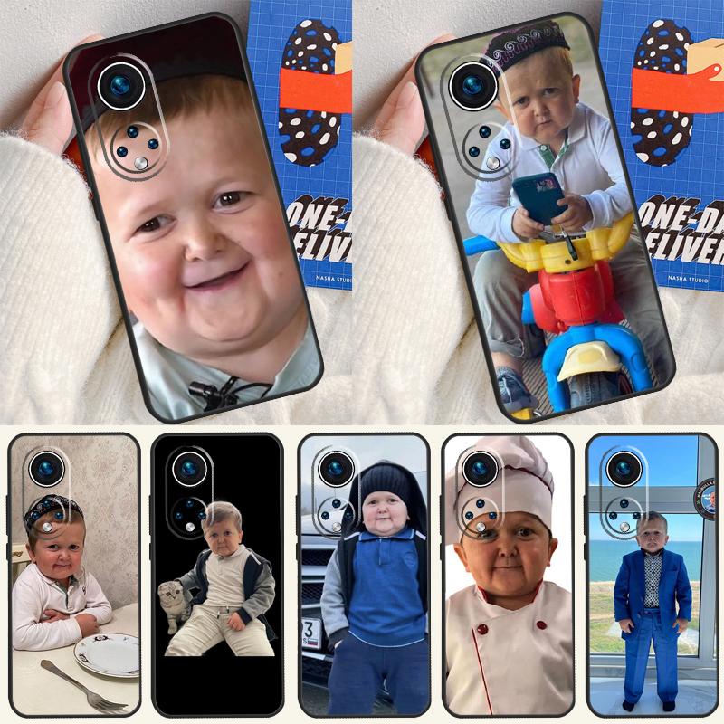Funny Hasbulla Case For Honor X9c X8a X8b X9b X9a X8 X9 50 70 90 Lite Honor 200 Pro Magic 5 6 7 Lire Cover