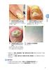 Visual Infectious Diseases: How Much Can You Diagnose by Appearance? An Atlas of Infectious Disease Images