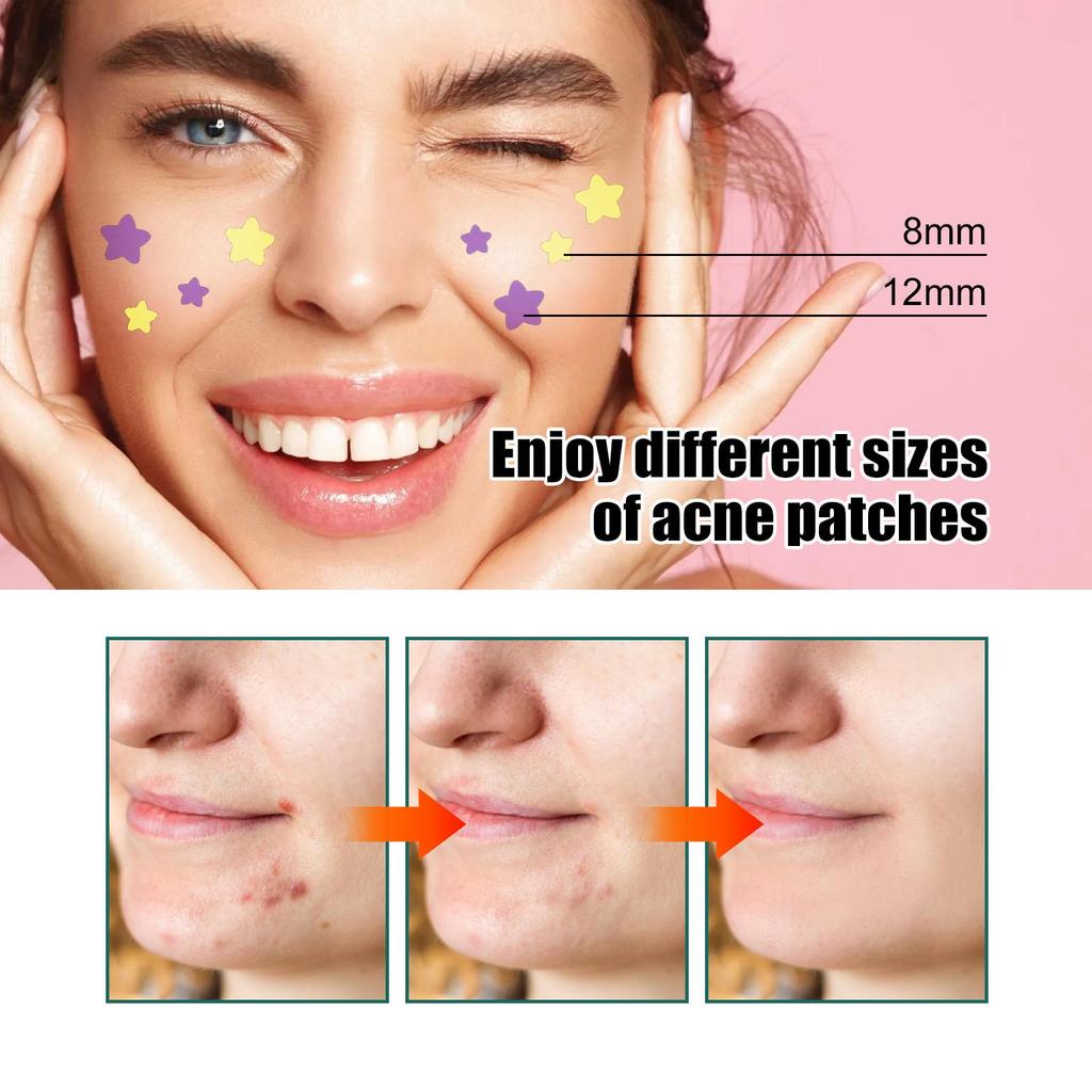 112pcs Acne Pimple Patch / Acne Treatment Stickers / Pimple Remover/Blemish Spot Face Skin Care