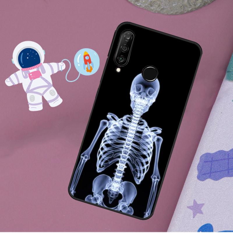 Radiological Human Organs Skeleton For Huawei Nova 12s 12i 11i 8i Y73 Y72 Y61 Y91 Y90 Y70 Y60 9 10 SE P30 P40 Lite P60 Pro Case